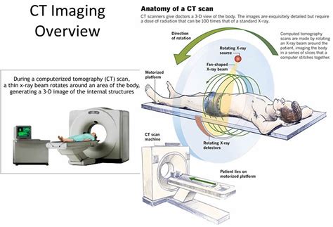 CT Scan (CAT Scan): Purpose, Procedure, Risks, Side Effects, .
